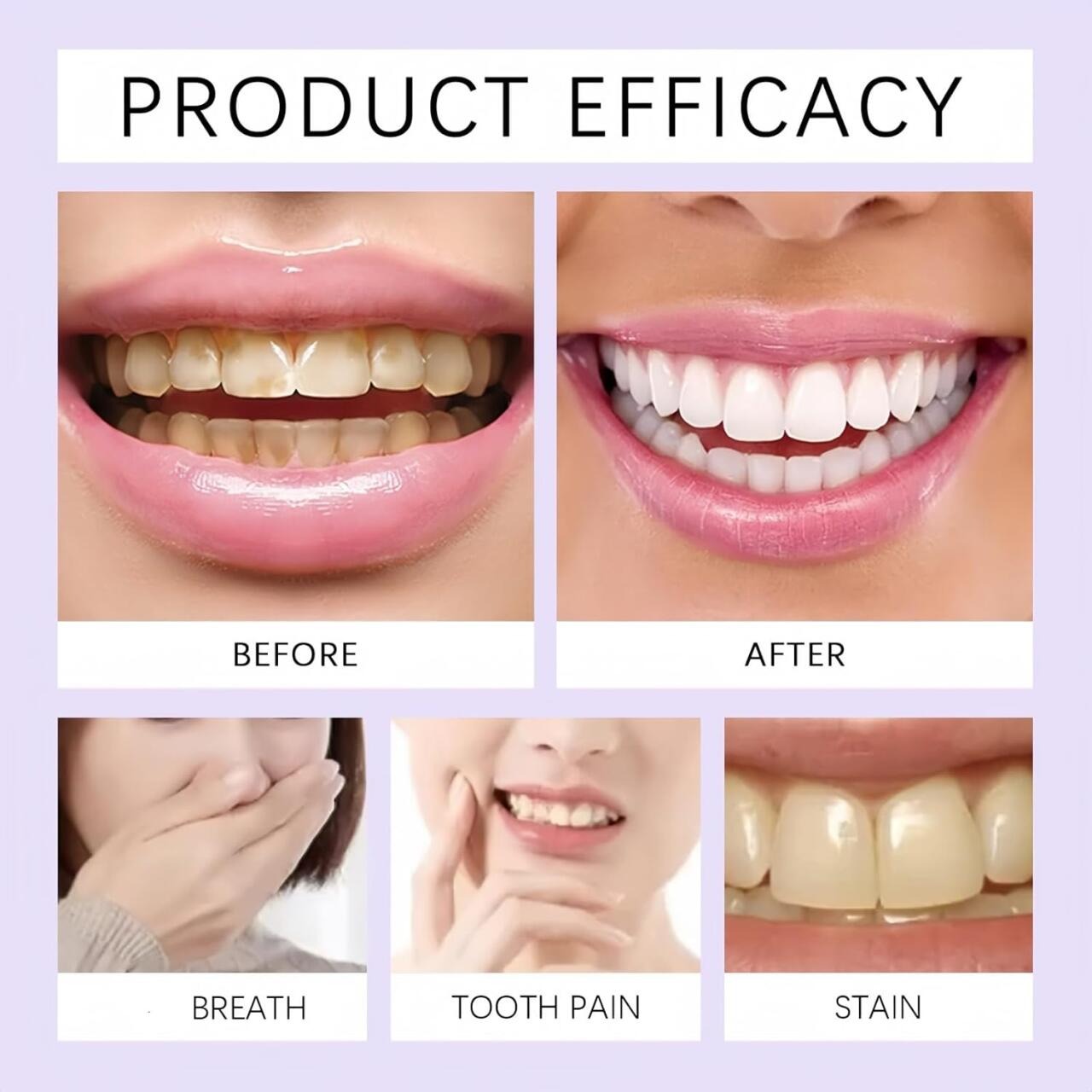 Tiras Blanqueadoras Dentales — Sonríe con Confianza